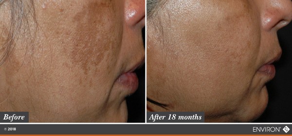 Skin Ess products 18 MONTHS
